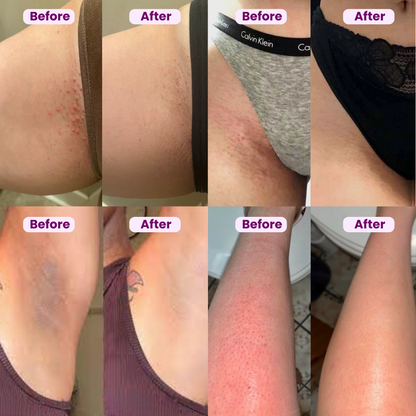 Barely Body SmoothCare Shaver